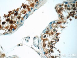 PPP2R4 Rabbit anti-Human, Mouse, Rat, Polyclonal, Proteintech 150 &mu;L;