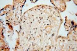 NUDT21 Rabbit anti-Human, Mouse, Rat, Polyclonal, Proteintech 20 &mu;L | Buy Online | Proteintech | Fisher Scientific