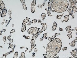 NUDT21 Rabbit anti-Human, Mouse, Rat, Polyclonal, Proteintech 20 &mu;L | Buy Online | Proteintech | Fisher Scientific