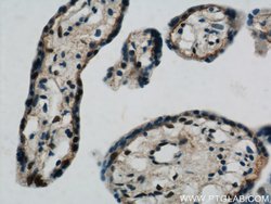 NUDT21 Rabbit anti-Human, Mouse, Rat, Polyclonal, Proteintech 20 &mu;L | Buy Online | Proteintech | Fisher Scientific