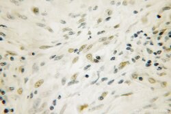 APEX1 Rabbit anti-Human, Mouse, Rat, Polyclonal, Proteintech:Antibodies:Primary