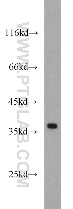 APEX1 Rabbit anti-Human, Mouse, Rat, Polyclonal, Proteintech:Antibodies:Primary