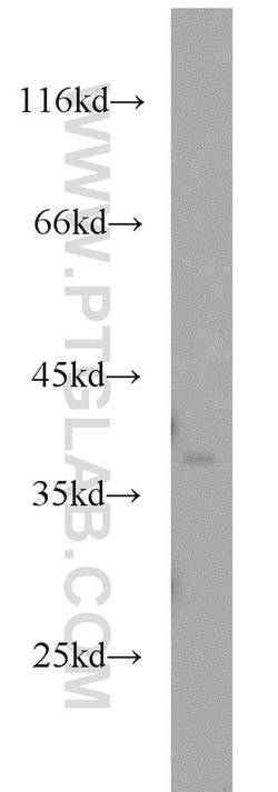 APEX1 Rabbit anti-Human, Mouse, Rat, Polyclonal, Proteintech:Antibodies:Primary