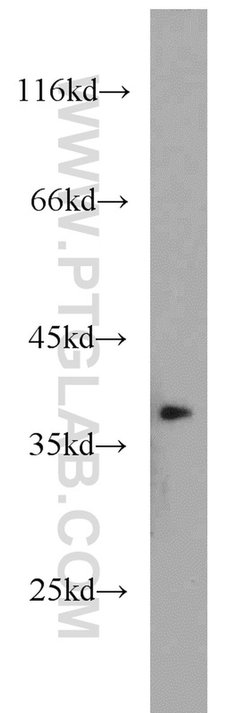 APEX1 Rabbit anti-Human, Mouse, Rat, Polyclonal, Proteintech:Antibodies:Primary
