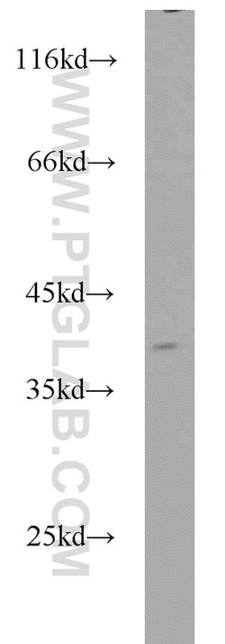 APEX1 Rabbit anti-Human, Mouse, Rat, Polyclonal, Proteintech:Antibodies:Primary
