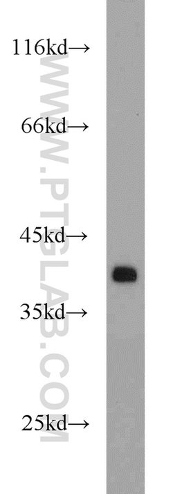 APEX1 Rabbit anti-Human, Mouse, Rat, Polyclonal, Proteintech:Antibodies:Primary