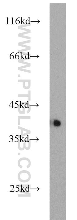 APEX1 Rabbit anti-Human, Mouse, Rat, Polyclonal, Proteintech:Antibodies:Primary
