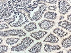 RAMP1 Rabbit anti-Human, Polyclonal, Proteintech:Antibodies:Primary Antibodies