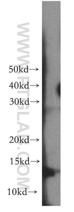RAMP1 Rabbit anti-Human, Polyclonal, Proteintech:Antibodies:Primary Antibodies