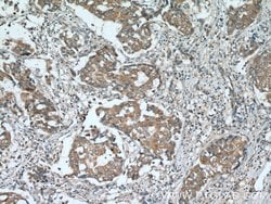 RARA Rabbit anti-Human, Mouse, Rat, Polyclonal, Proteintech 150 &mu;L;