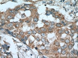 RARA Rabbit anti-Human, Mouse, Rat, Polyclonal, Proteintech 150 &mu;L;