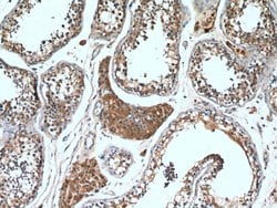 RARA Rabbit anti-Human, Mouse, Rat, Polyclonal, Proteintech 150 &mu;L;