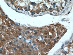 RARA Rabbit anti-Human, Mouse, Rat, Polyclonal, Proteintech 150 &mu;L;