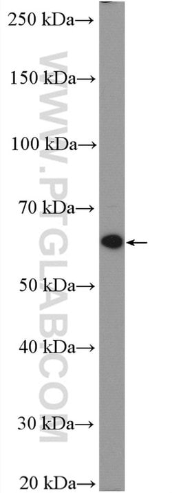 RARA Rabbit anti-Human, Mouse, Rat, Polyclonal, Proteintech 150 &mu;L;
