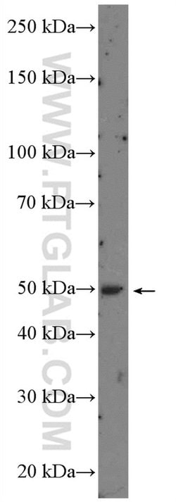 RARA Rabbit anti-Human, Mouse, Rat, Polyclonal, Proteintech 150 &mu;L;