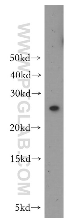 MAD2L1 Rabbit anti-Human, Mouse, Rat, Polyclonal, Proteintech 150 &mu;L;