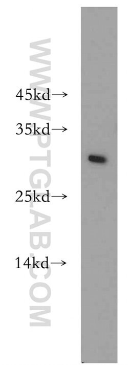 MAD2L1 Rabbit anti-Human, Mouse, Rat, Polyclonal, Proteintech 150 &mu;L;