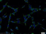 Thumbnail_RAB6B Rabbit anti-Human, Mouse, Rat, Polyclonal, Proteintech 150 &mu;L;