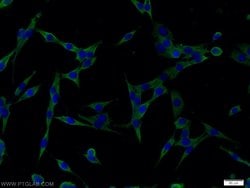 RAB6B Rabbit anti-Human, Mouse, Rat, Polyclonal, Proteintech:Antibodies:Primary