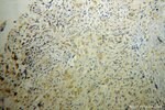 Thumbnail_RAB6B Rabbit anti-Human, Mouse, Rat, Polyclonal, Proteintech 150 &mu;L;