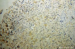 RAB6B Rabbit anti-Human, Mouse, Rat, Polyclonal, Proteintech:Antibodies:Primary