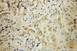 Thumbnail_RAB6B Rabbit anti-Human, Mouse, Rat, Polyclonal, Proteintech 150 &mu;L;