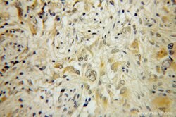 RAB6B Rabbit anti-Human, Mouse, Rat, Polyclonal, Proteintech:Antibodies:Primary