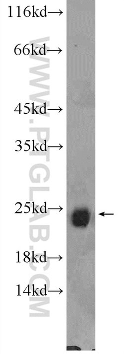 RAB6B Rabbit anti-Human, Mouse, Rat, Polyclonal, Proteintech:Antibodies:Primary