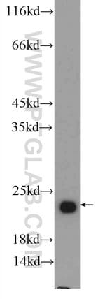 Thumbnail_RAB6B Rabbit anti-Human, Mouse, Rat, Polyclonal, Proteintech 150 &mu;L;