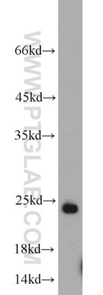Thumbnail_RAB6B Rabbit anti-Human, Mouse, Rat, Polyclonal, Proteintech 150 &mu;L;