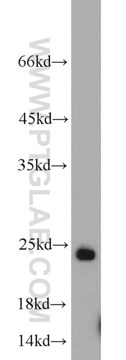 RAB6B Rabbit anti-Human, Mouse, Rat, Polyclonal, Proteintech:Antibodies:Primary
