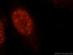 UBE3A Rabbit anti-Human, Mouse, Rat, Polyclonal, Proteintech 20 &mu;L | Buy Online | Proteintech | Fisher Scientific