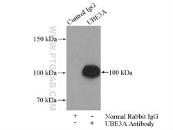 UBE3A Rabbit anti-Human, Mouse, Rat, Polyclonal, Proteintech 20 &mu;L | Buy Online | Proteintech | Fisher Scientific