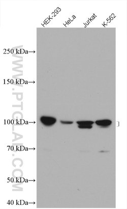 UBE3A Rabbit anti-Human, Mouse, Rat, Polyclonal, Proteintech 20 &mu;L | Buy Online | Proteintech | Fisher Scientific
