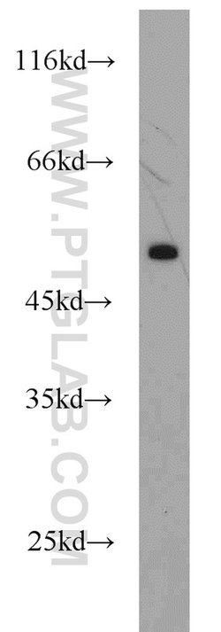 CTBP2 Rabbit anti-Human, Mouse, Rat, Polyclonal, Proteintech:Antibodies:Primary