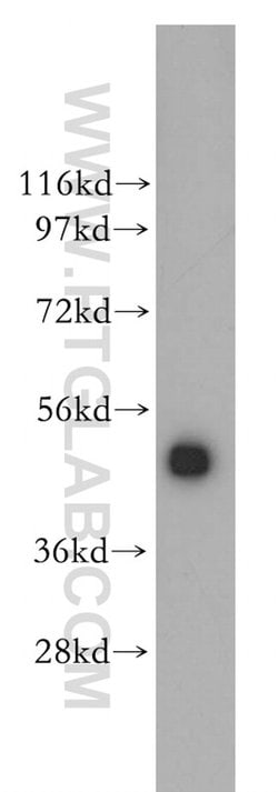 CTBP2 Rabbit anti-Human, Mouse, Rat, Polyclonal, Proteintech:Antibodies:Primary