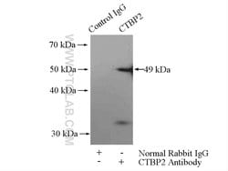 CTBP2 Rabbit anti-Human, Mouse, Rat, Polyclonal, Proteintech:Antibodies:Primary