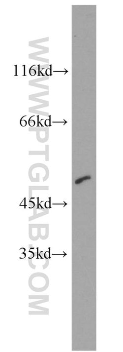 CTBP2 Rabbit anti-Human, Mouse, Rat, Polyclonal, Proteintech:Antibodies:Primary