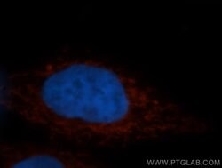STOML2 Rabbit anti-Human, Mouse, Rat, Polyclonal, Proteintech:Antibodies:Primary
