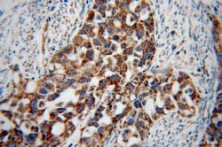 STOML2 Rabbit anti-Human, Mouse, Rat, Polyclonal, Proteintech:Antibodies:Primary