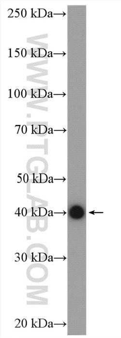 STOML2 Rabbit anti-Human, Mouse, Rat, Polyclonal, Proteintech:Antibodies:Primary