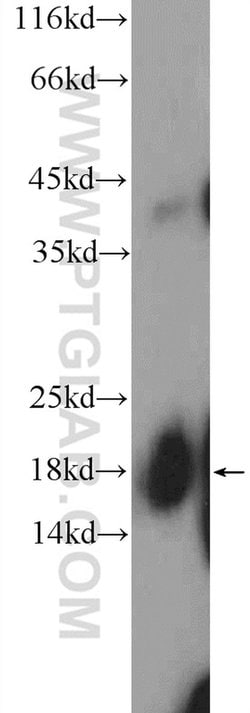 SNRPD1 Rabbit anti-Human, Mouse, Rat, Polyclonal, Proteintech:Antibodies:Primary