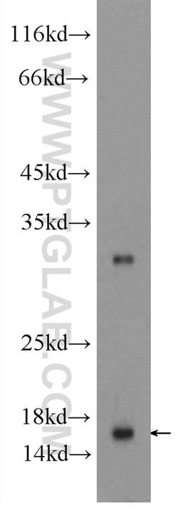 SNRPD1 Rabbit anti-Human, Mouse, Rat, Polyclonal, Proteintech:Antibodies:Primary