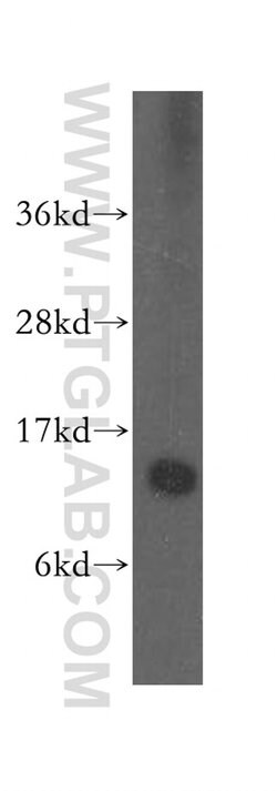 SNRPD1 Rabbit anti-Human, Mouse, Rat, Polyclonal, Proteintech:Antibodies:Primary