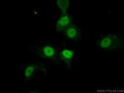 P21 Rabbit anti-Human, Polyclonal, Proteintech:Antibodies:Primary Antibodies