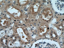 P21 Rabbit anti-Human, Polyclonal, Proteintech:Antibodies:Primary Antibodies