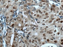P21 Rabbit anti-Human, Polyclonal, Proteintech:Antibodies:Primary Antibodies