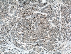P21 Rabbit anti-Human, Polyclonal, Proteintech:Antibodies:Primary Antibodies