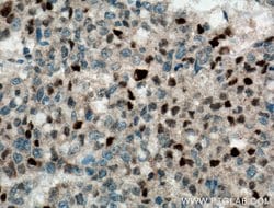 P21 Rabbit anti-Human, Polyclonal, Proteintech:Antibodies:Primary Antibodies
