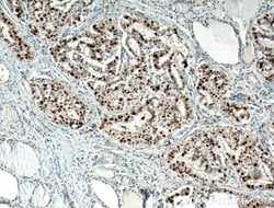 P21 Rabbit anti-Human, Polyclonal, Proteintech:Antibodies:Primary Antibodies